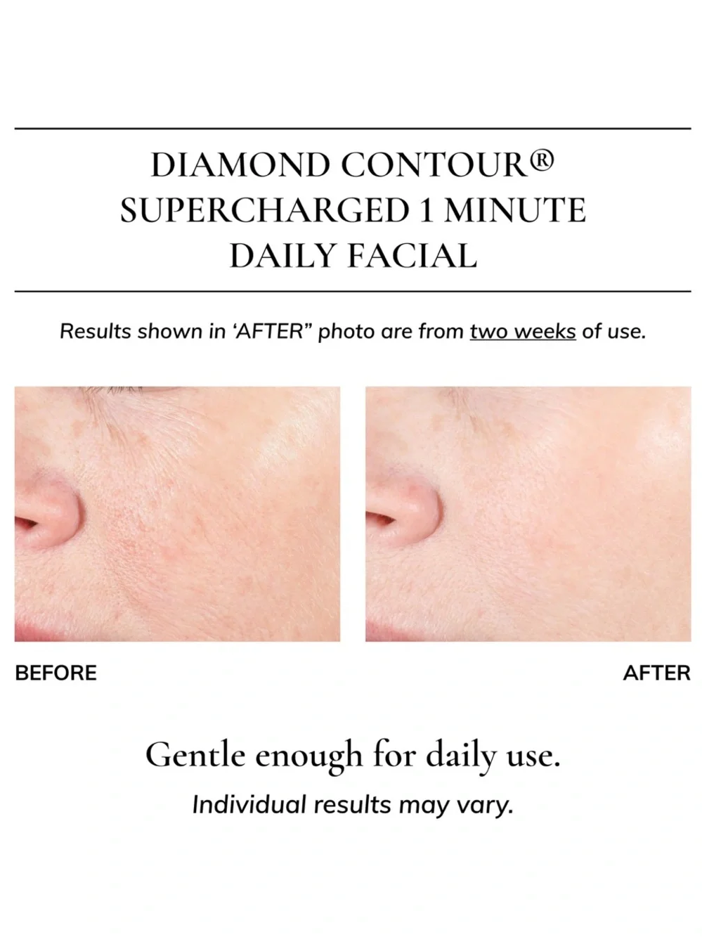 Kaplan MD Diamond Contour Supercharged 1 Minute Daily Facial 3oz/90ml